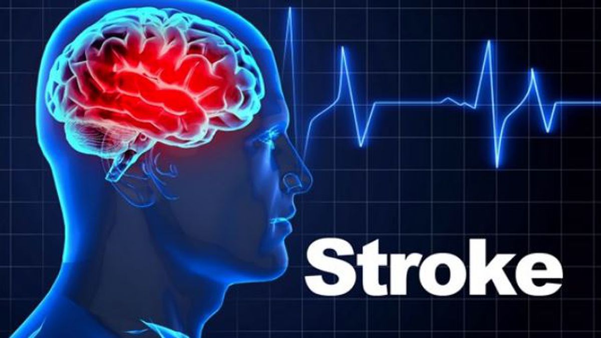 quick-information-and-myths-brain-stroke-best-multispeciality